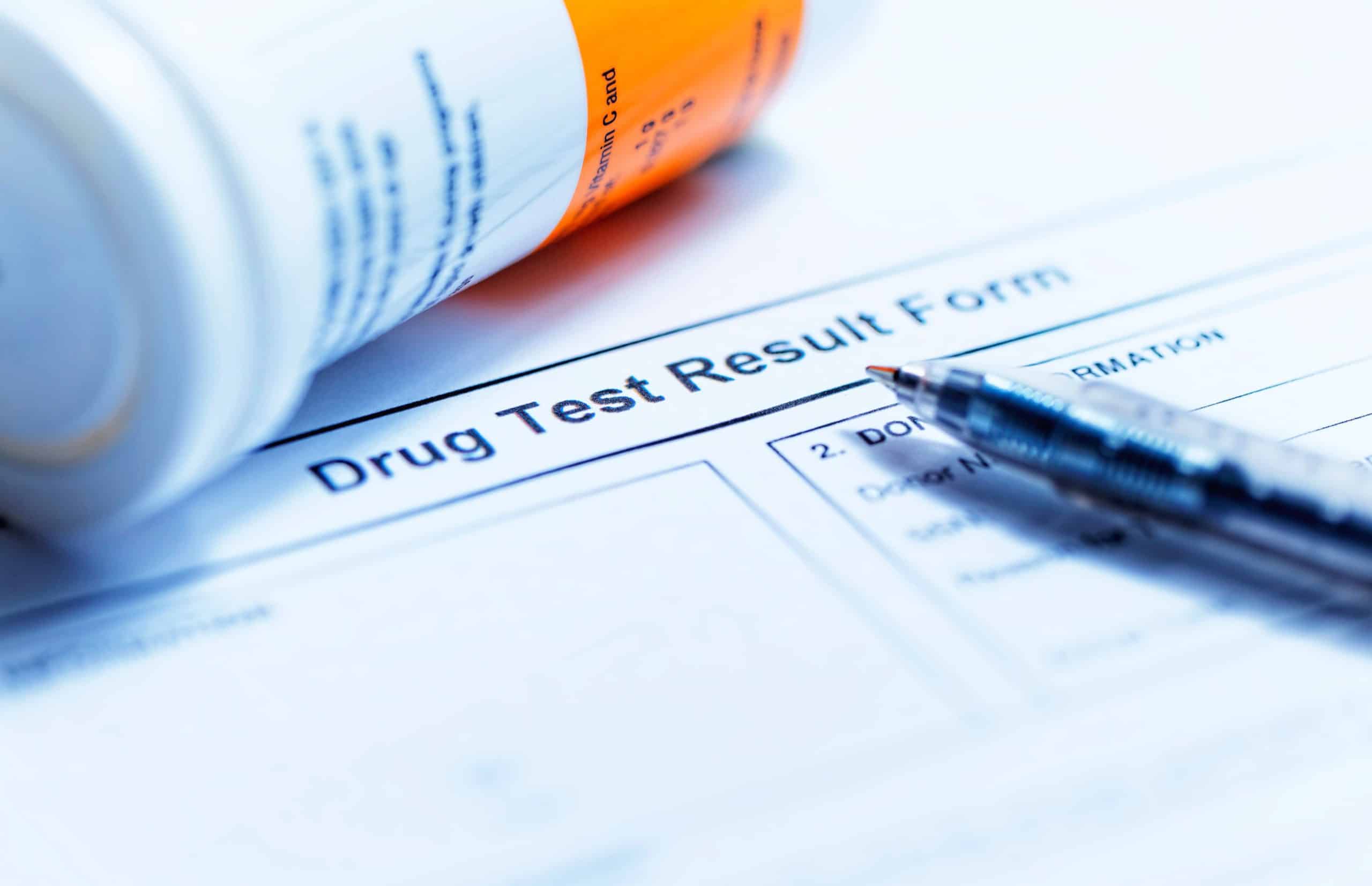 Hair Drug Test – A Precise Way to Spot Drug Abuses